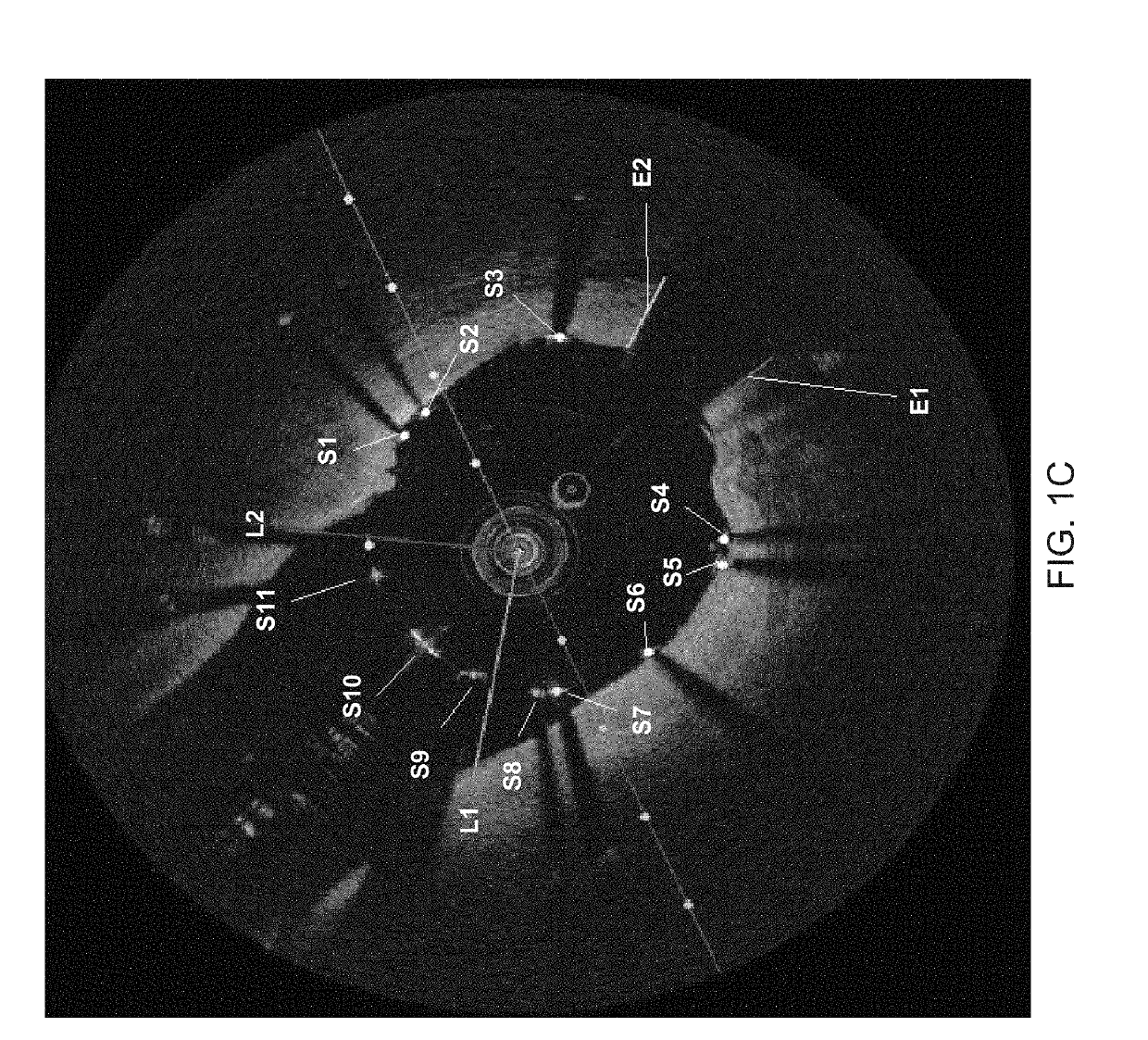 Detection of Stent Struts Relative to Side Branches