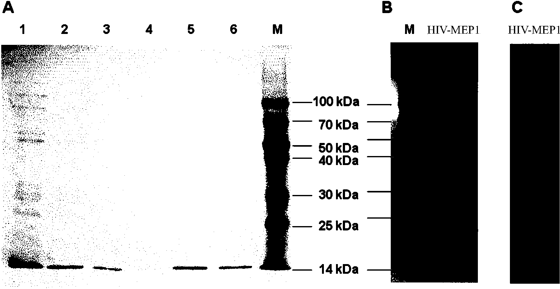 HIV-1 multi-epitope recombinant protein, and encoding gene and application thereof