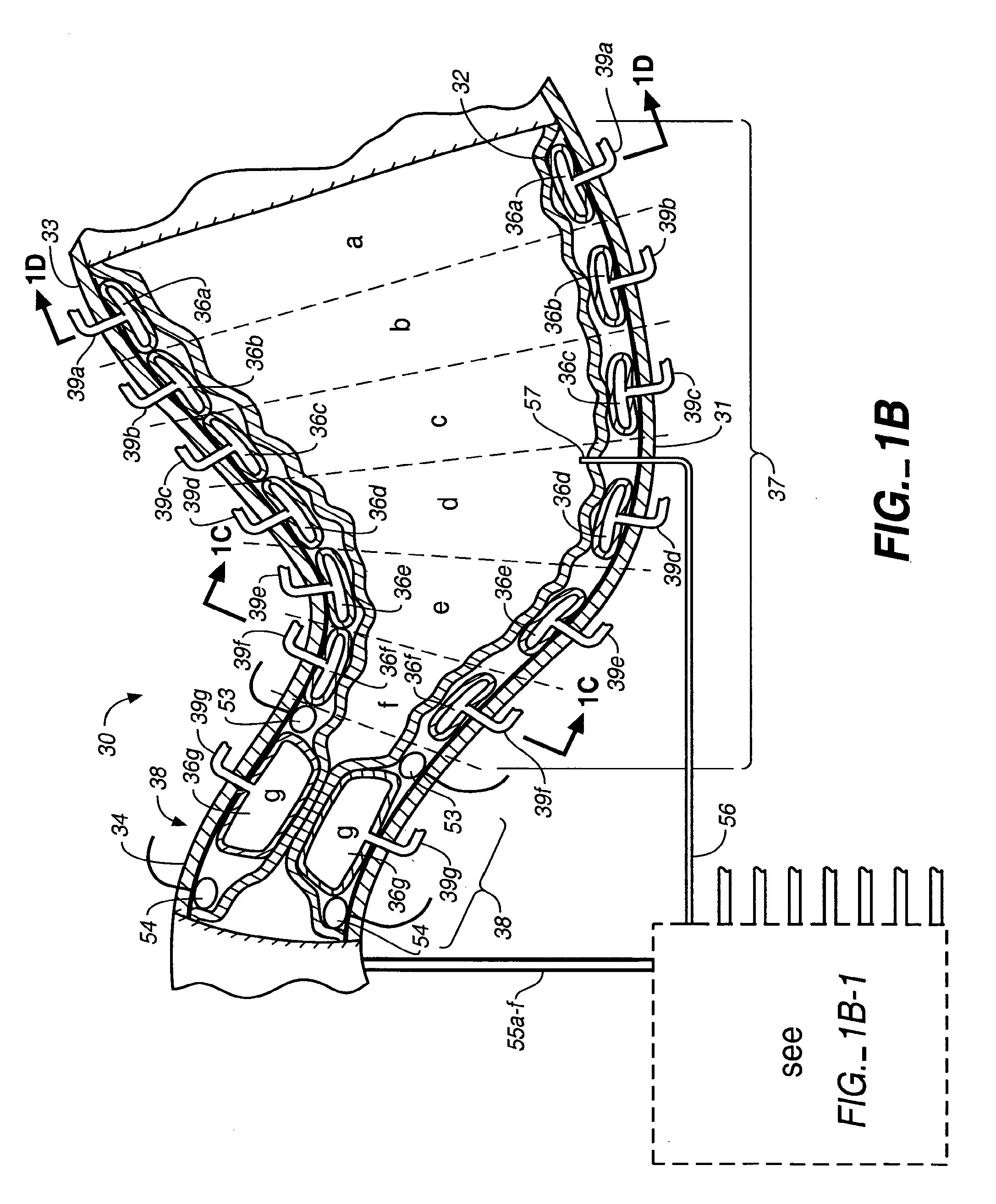 Stomach prosthesis