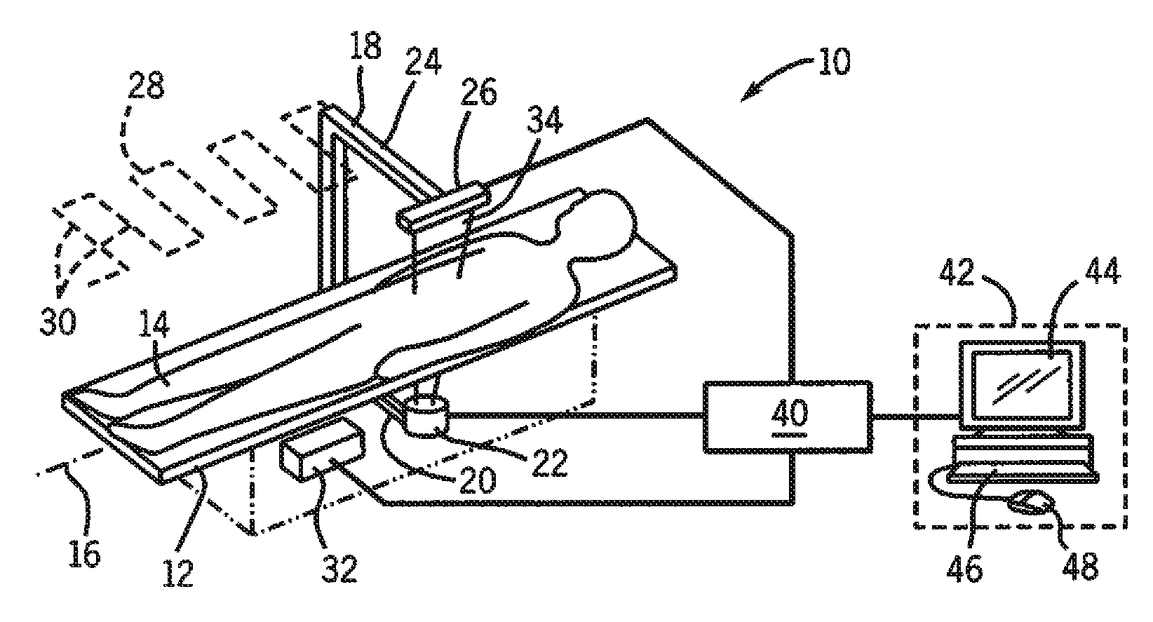 Transverse scanning bone densitometer and detector used in same