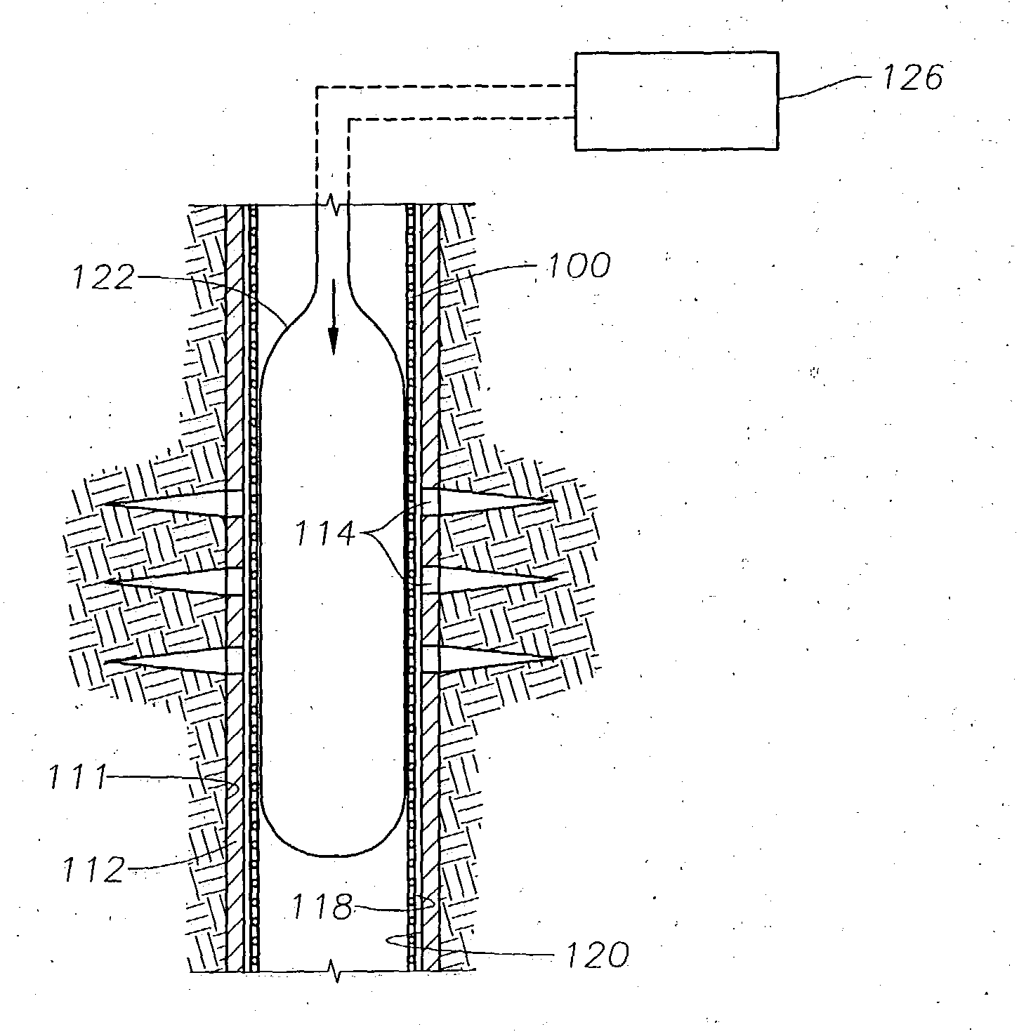 System and methods for placing a braided tubular sleeve in a well bore