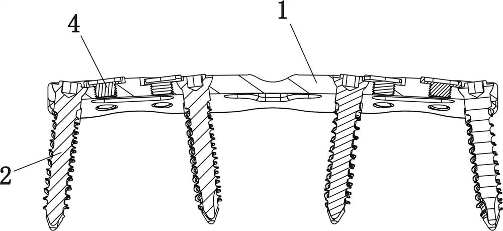 Internal fixation system for anterior cervical steel plate