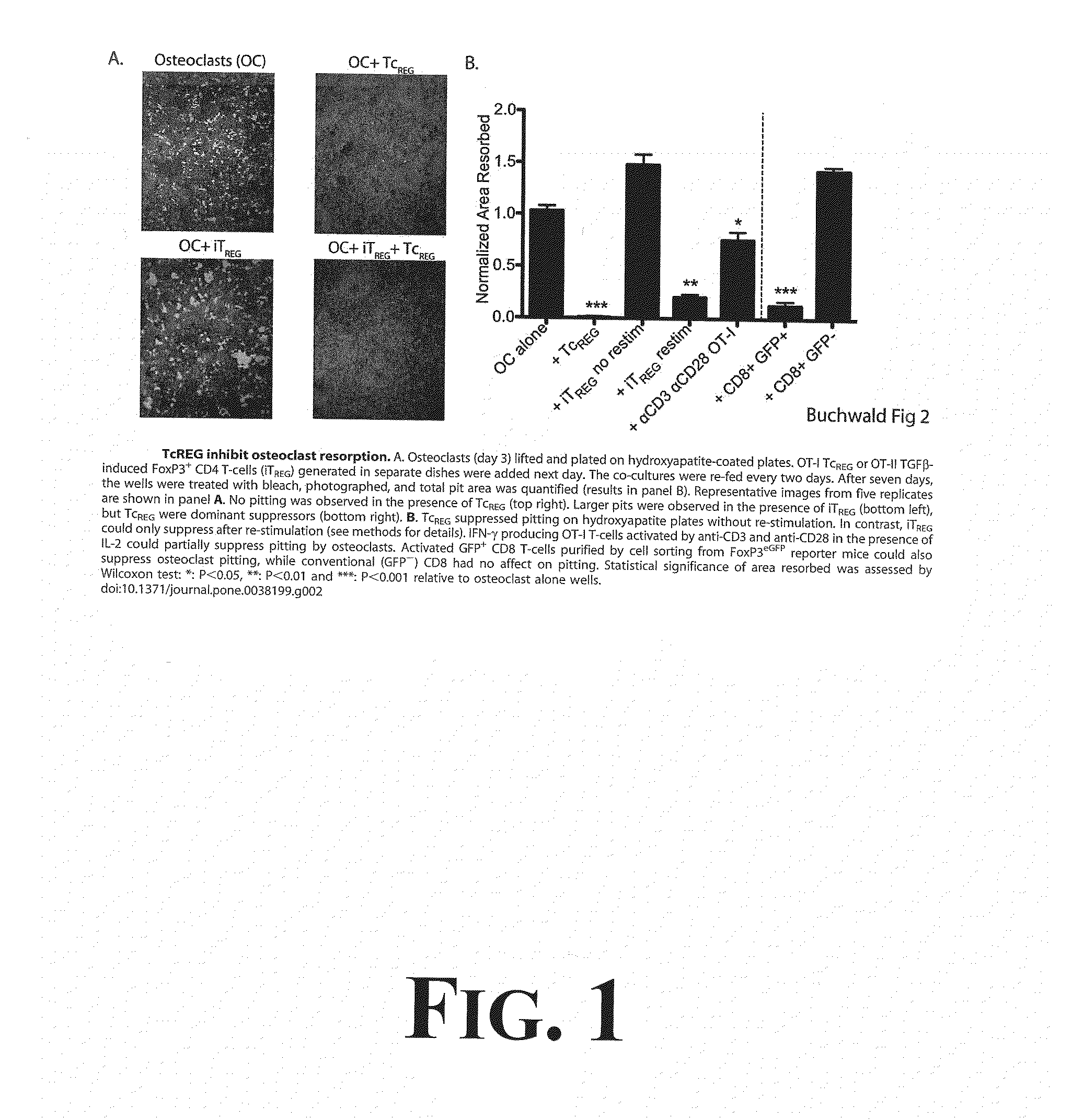 Suppression of Bone Loss by Introducing FoxP3+ CD8 T-cells (TcREG)