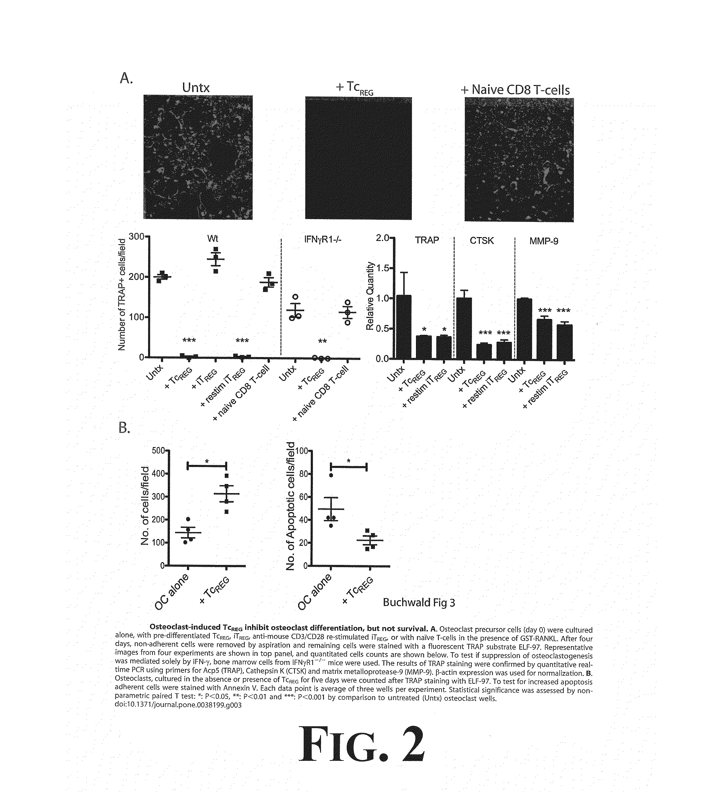 Suppression of Bone Loss by Introducing FoxP3+ CD8 T-cells (TcREG)