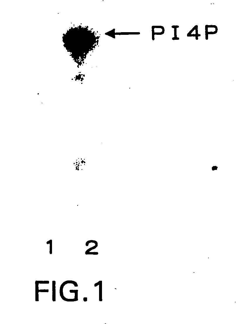 Human skeletal muscle-specific ubiquitin-conjugating emzyme