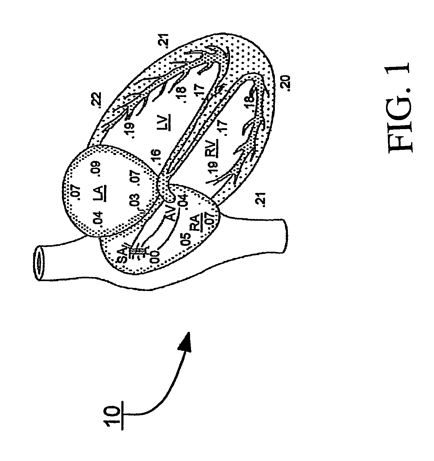 Apparatus and methods of energy efficient, atrial-based Bi-ventricular fusion-pacing