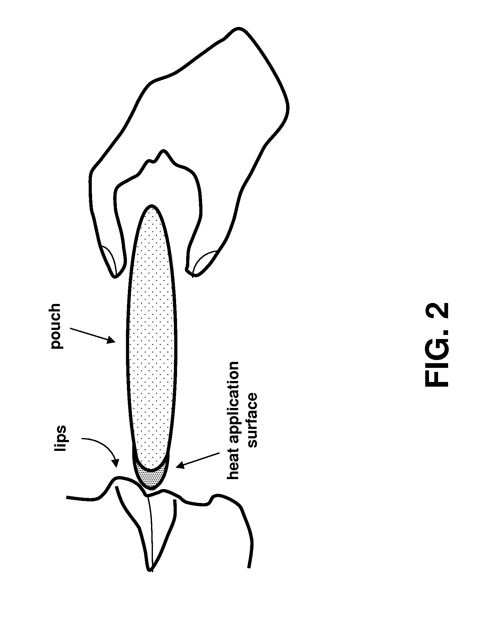 Chemical warming device and method for the treatment of viruses such as herpes