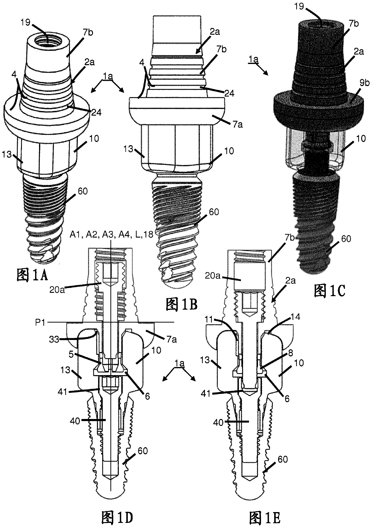 Assembly for dental restoration