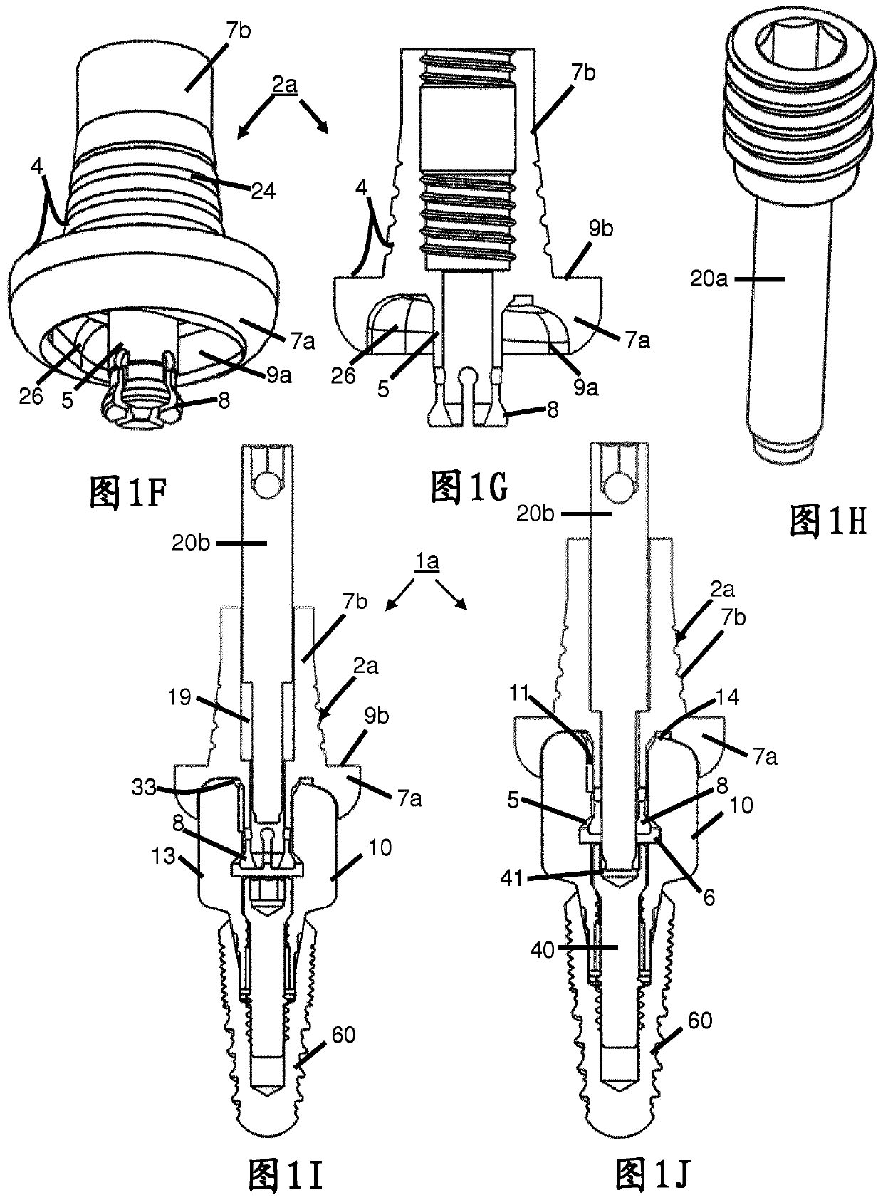 Assembly for dental restoration