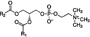 Preparation method and application of gemcitabine-phospholipid complex