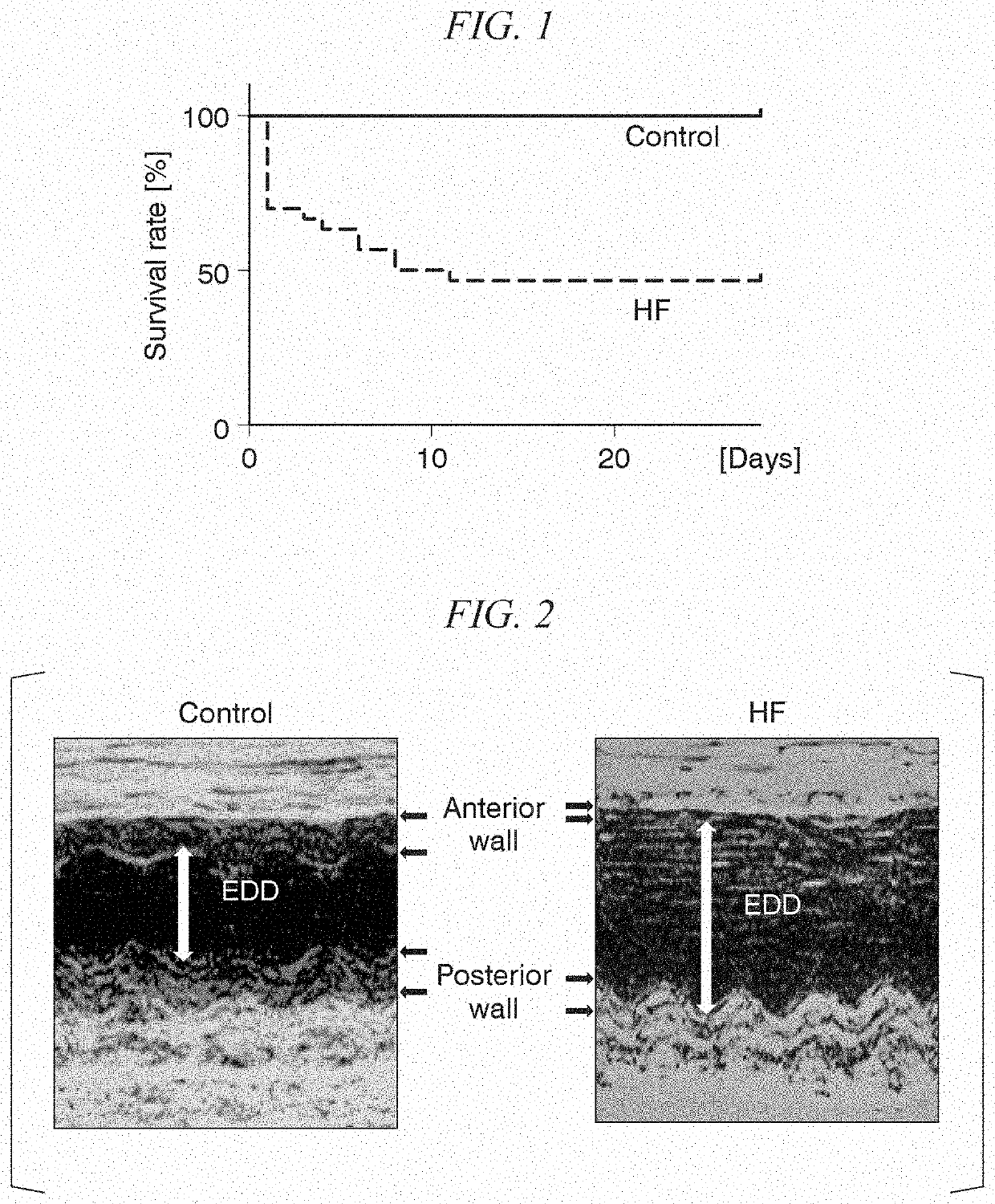 Method of evaluating pathological conditions of heart failure