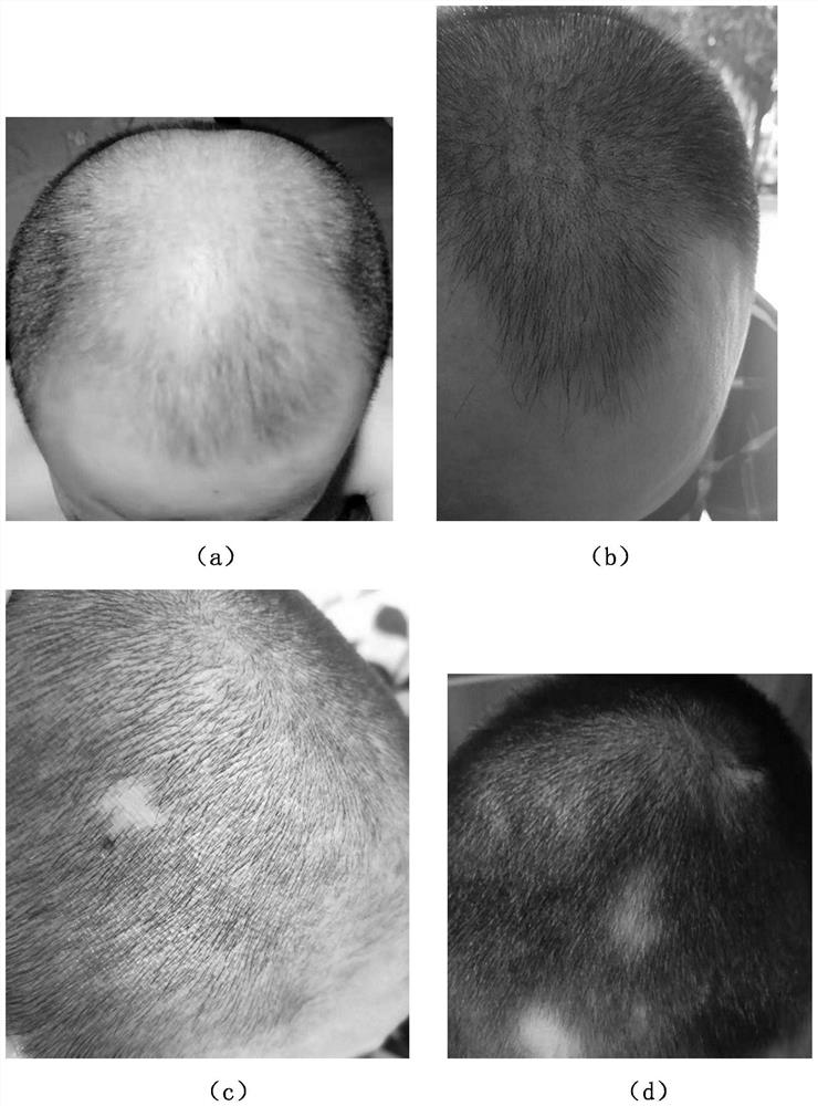 Plant hair loss prevention and hair growth liquid, and preparation method and application thereof
