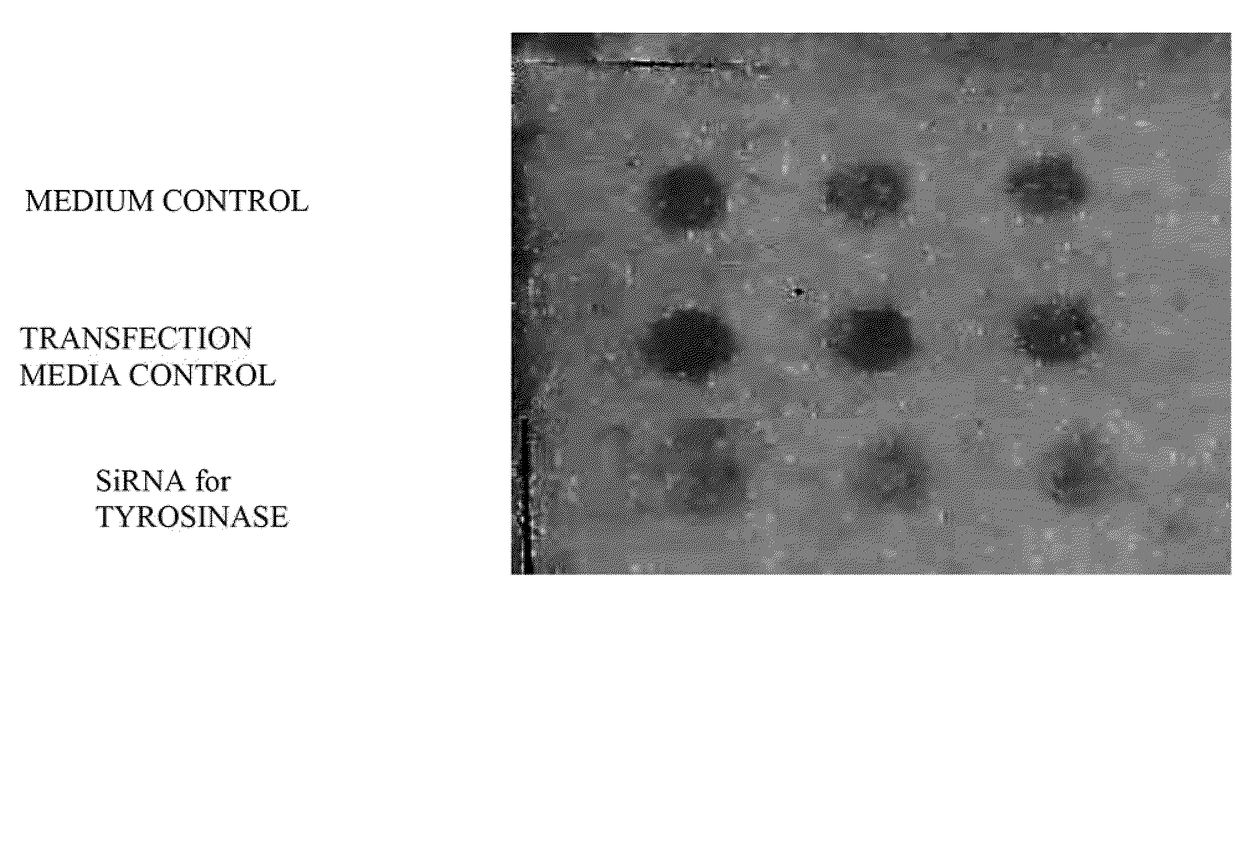 si-RNA-mediated gene silencing technology to inhibit tyrosinase and reduce pigmentation