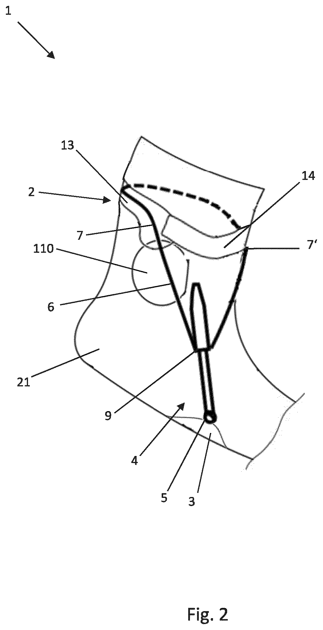 Foot movement limiting device and shoe