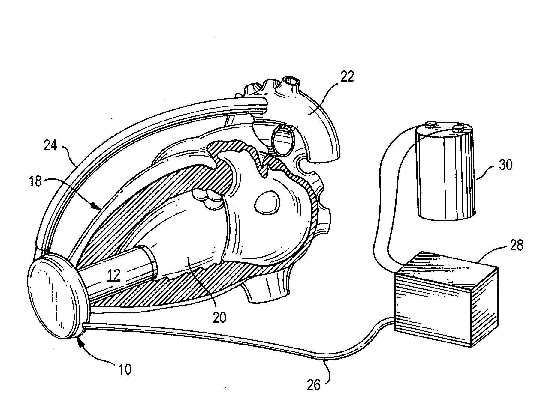 Sensorless Flow Estimation for Implanted Ventricle Assist Device