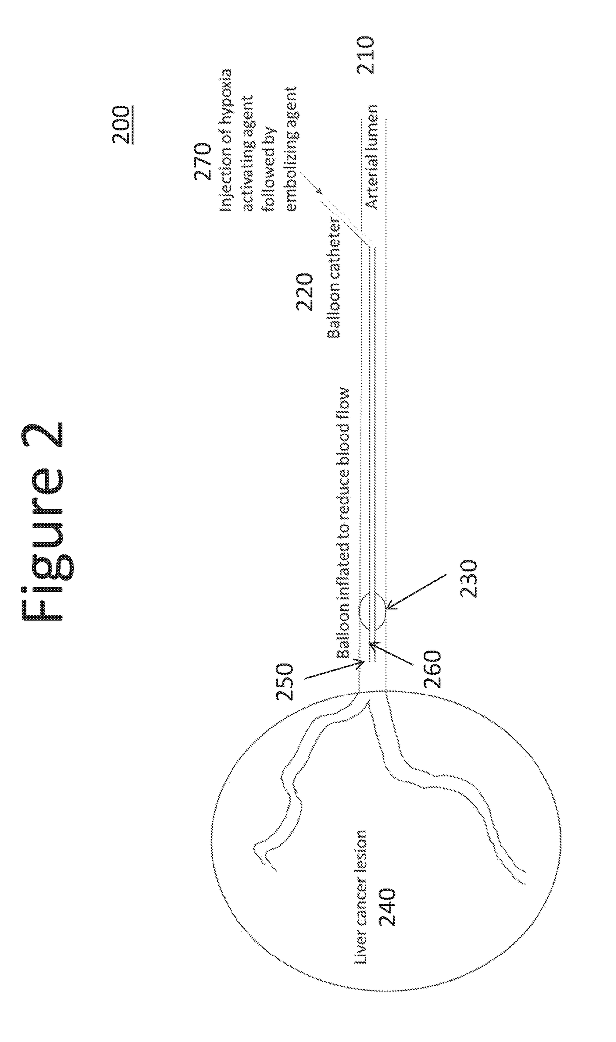 Methods for treating liver tissue