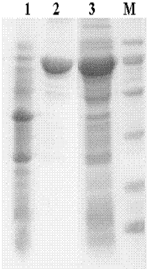 A method for preparing xylooligosaccharides and xylose by using genetic engineering co-immobilized xylan degrading enzymes