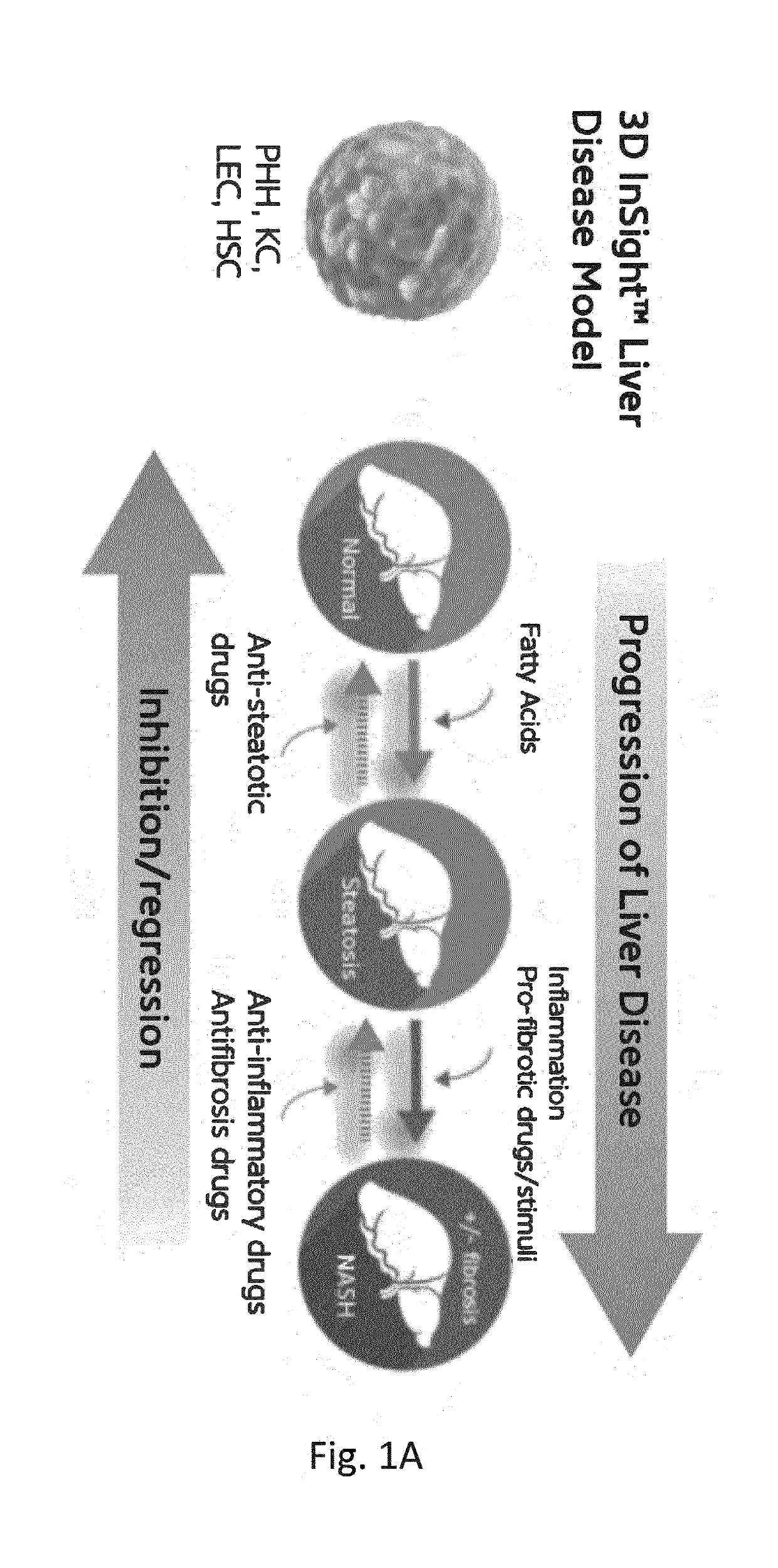 Screenable liver disease models and methods