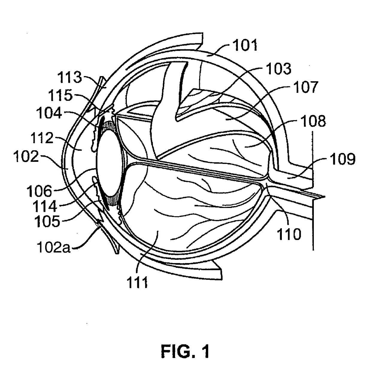 Processes and apparatus for preventing, delaying or ameliorating one or more symptoms of presbyopia