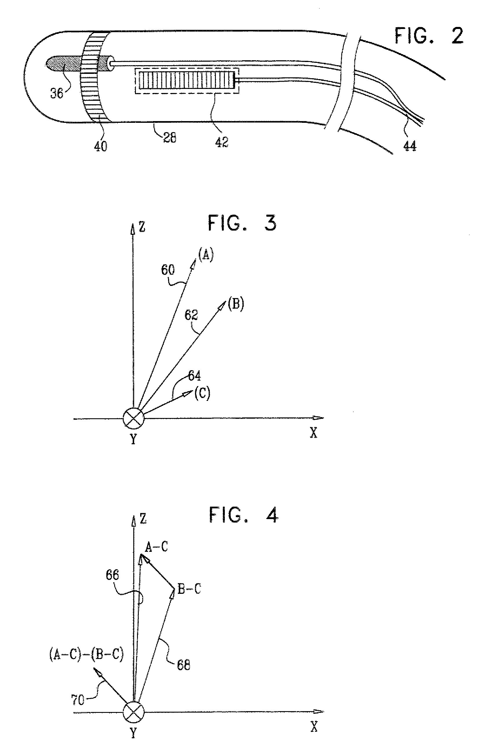 Intracorporeal location system with movement compensation