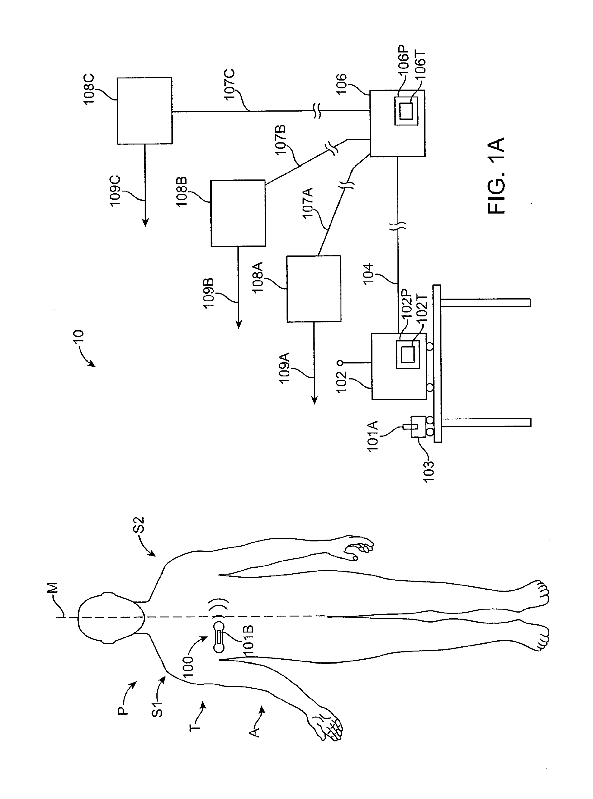 Method and Apparatus for Remote Detection and Monitoring of Functional Chronotropic Incompetence