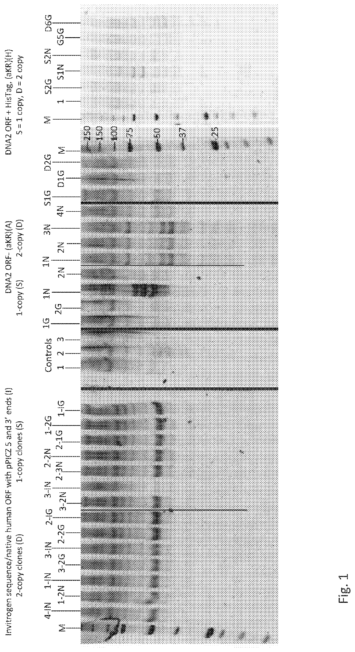 Methods and compositions for alpha-1 antitrypsin related disease disorders