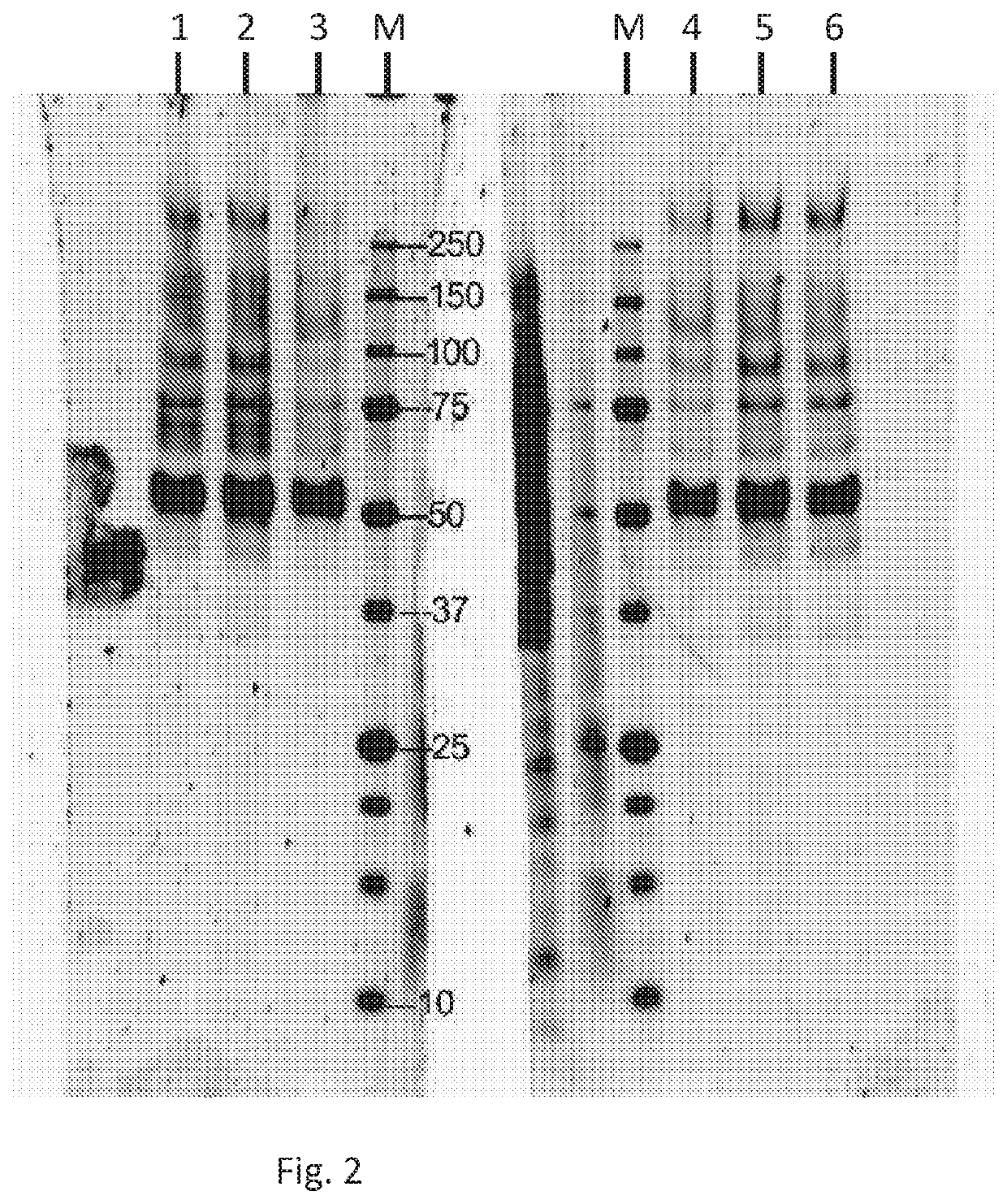 Methods and compositions for alpha-1 antitrypsin related disease disorders