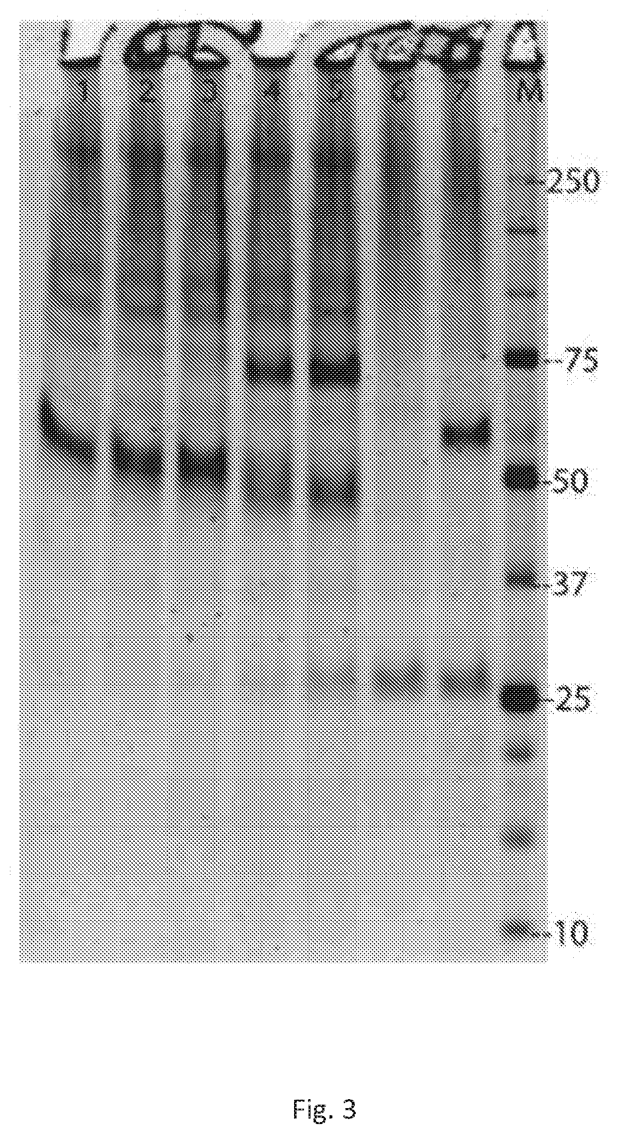 Methods and compositions for alpha-1 antitrypsin related disease disorders