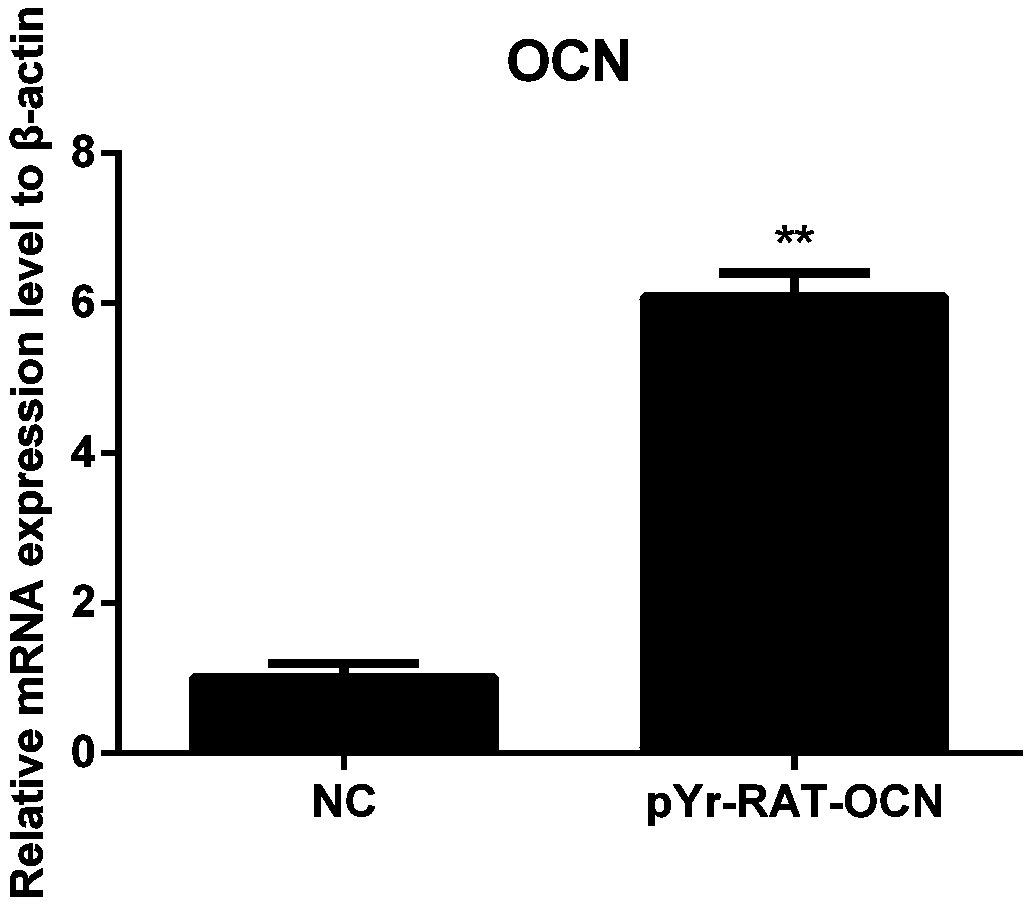 Application of osteocalcin in the regulation of endothelial progenitor exosomes