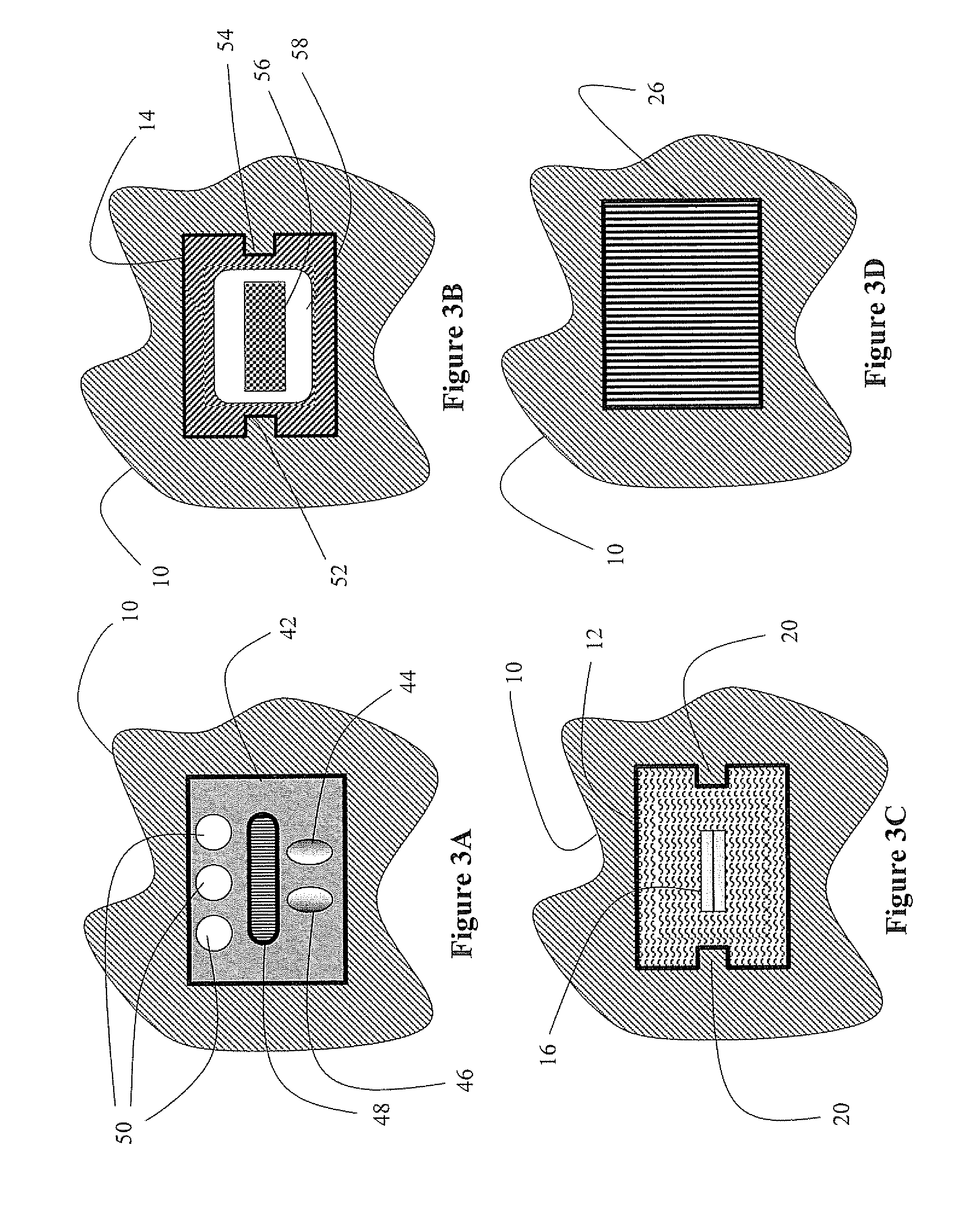 Internal ufd