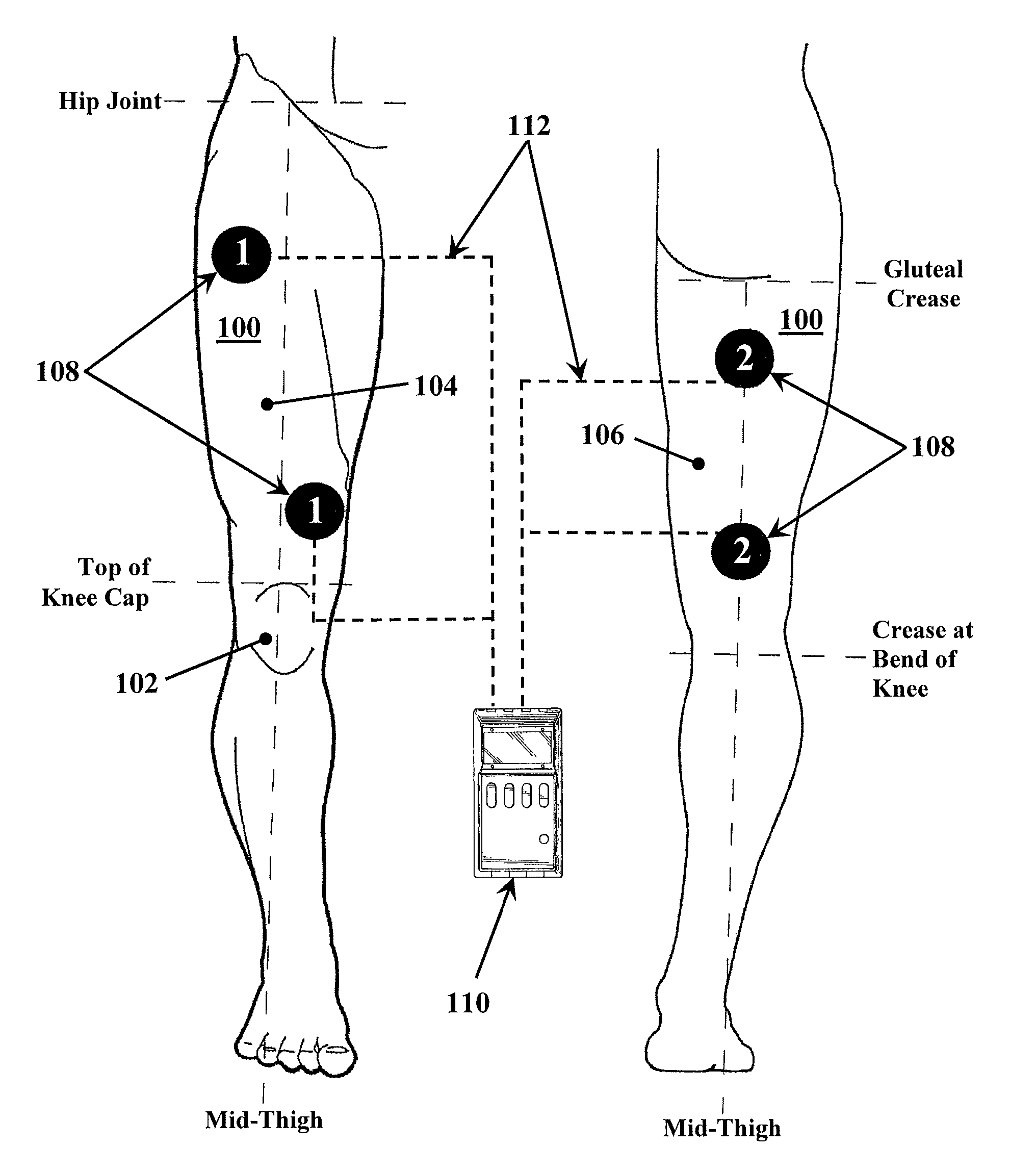 Apparatus and method for stabilizing, improving mobility, and controlling cartilage matrix degradation of weight-bearing articular joints
