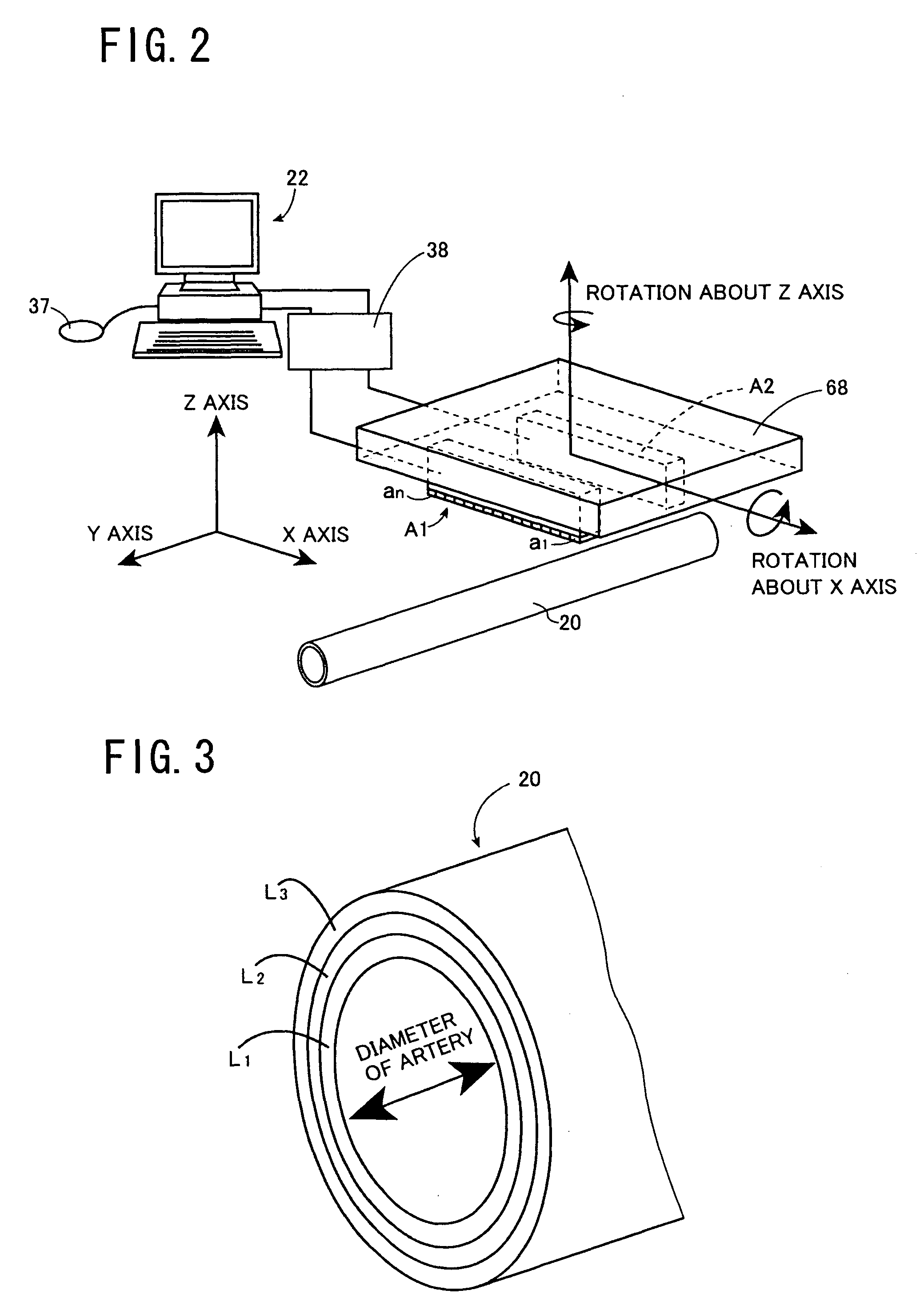 Blood vessel endothelium function evaluating apparatus provided with an electronic control device