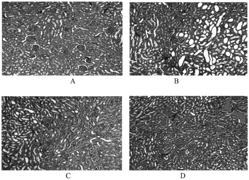 Traditional Chinese medicine composition for preventing and treating high uric acid and hyperlipidemia and its preparation method