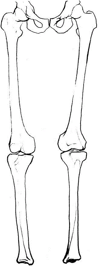 Individual orthopedics department positioning sheet based on medical images