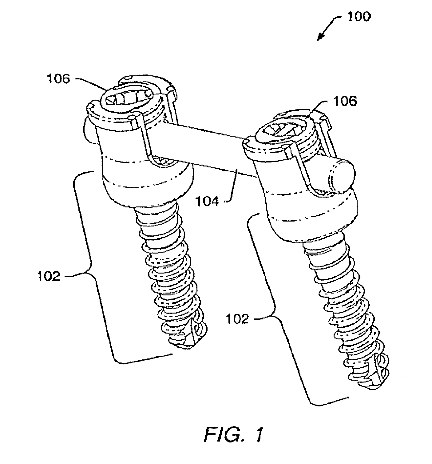 Stabilization system and method