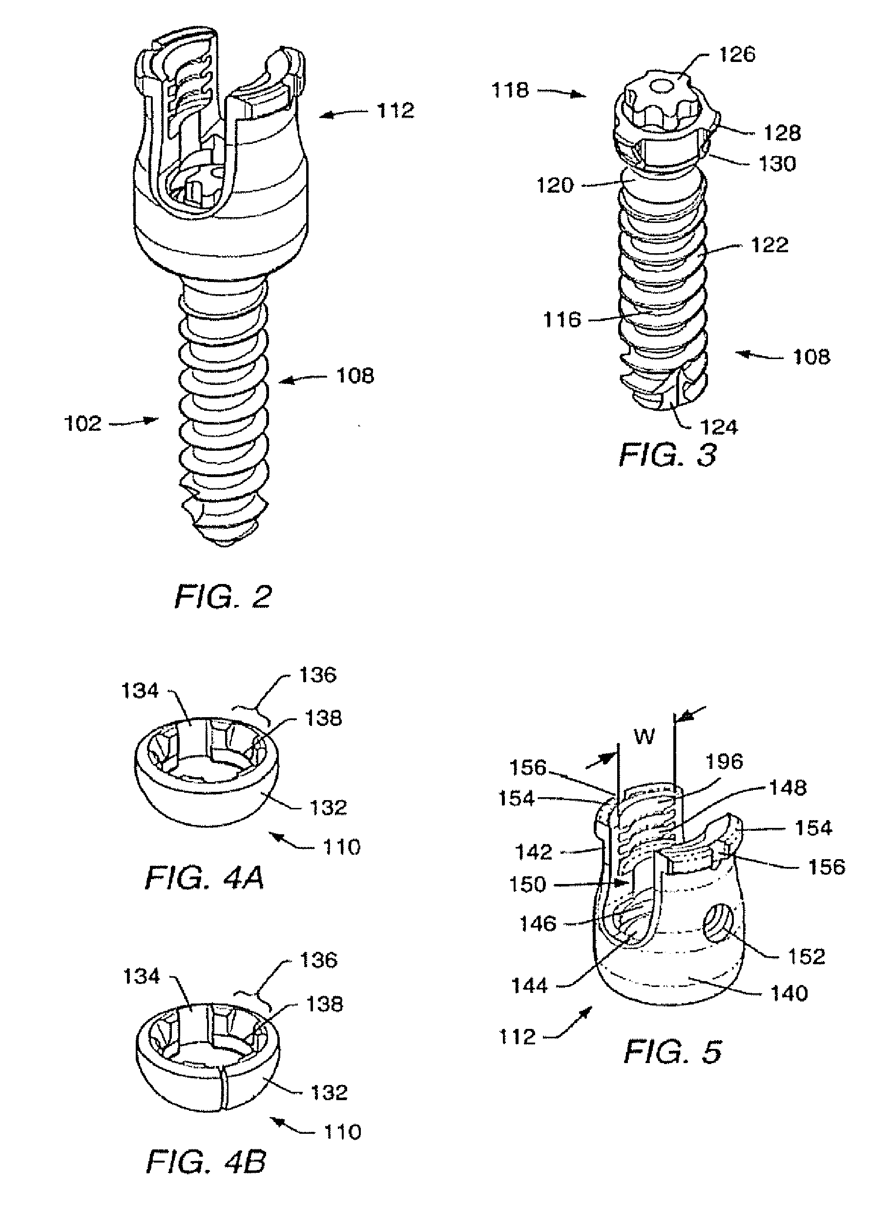 Stabilization system and method
