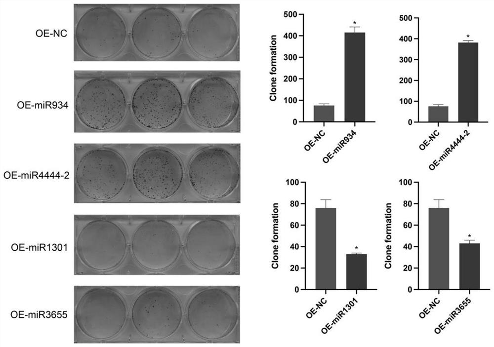 Kit for detecting prognosis condition of pancreatic cancer