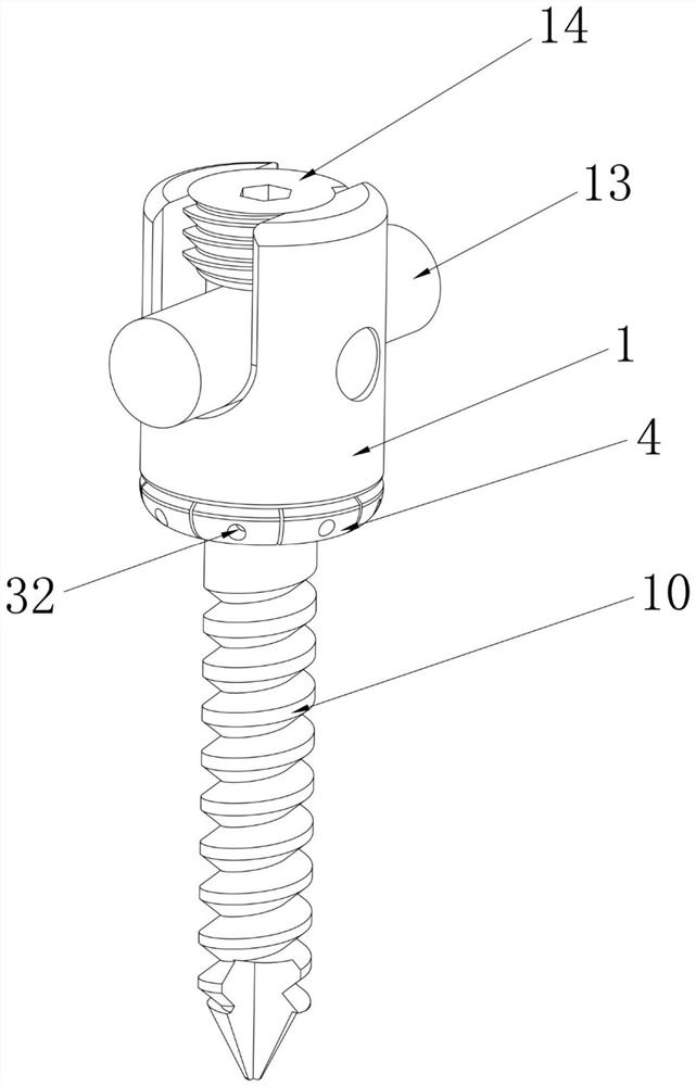 Split dynamic and static dual-purpose pedicle screw and mounting tool thereof