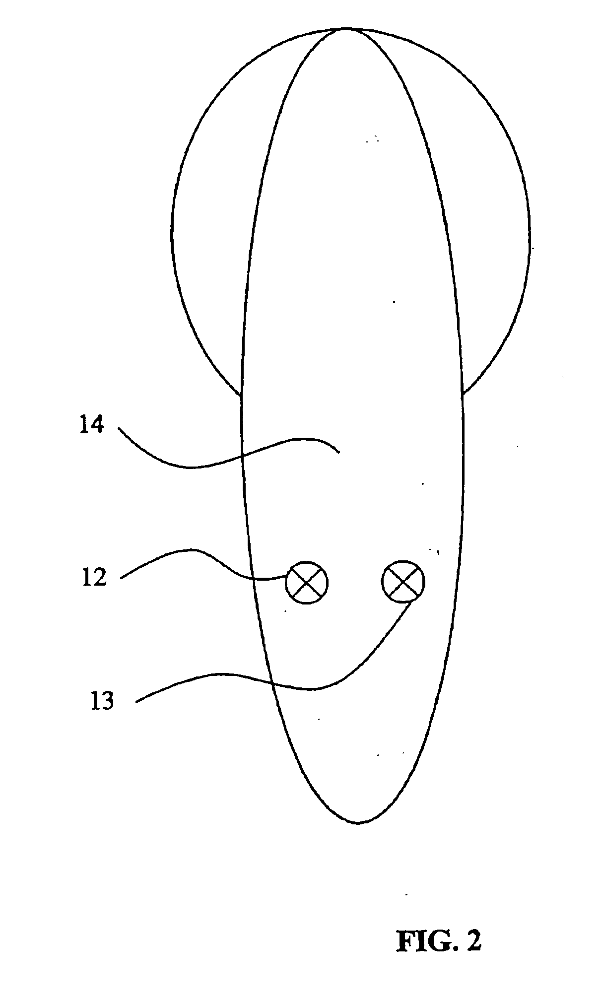 Device for determining acoustically evoked brain potentials
