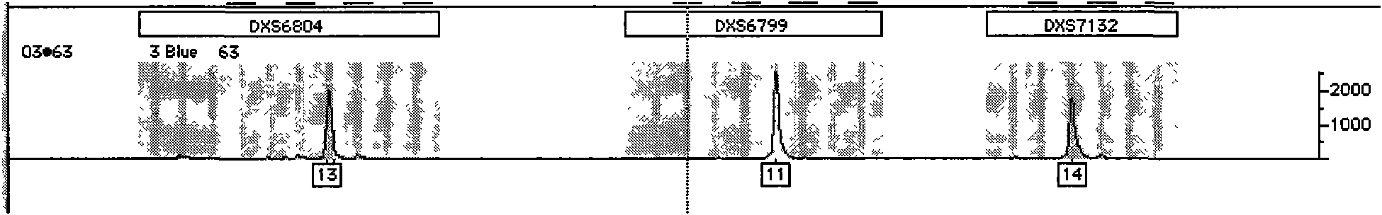 Fluorescent detecting method for X chromosome STR gene site typing