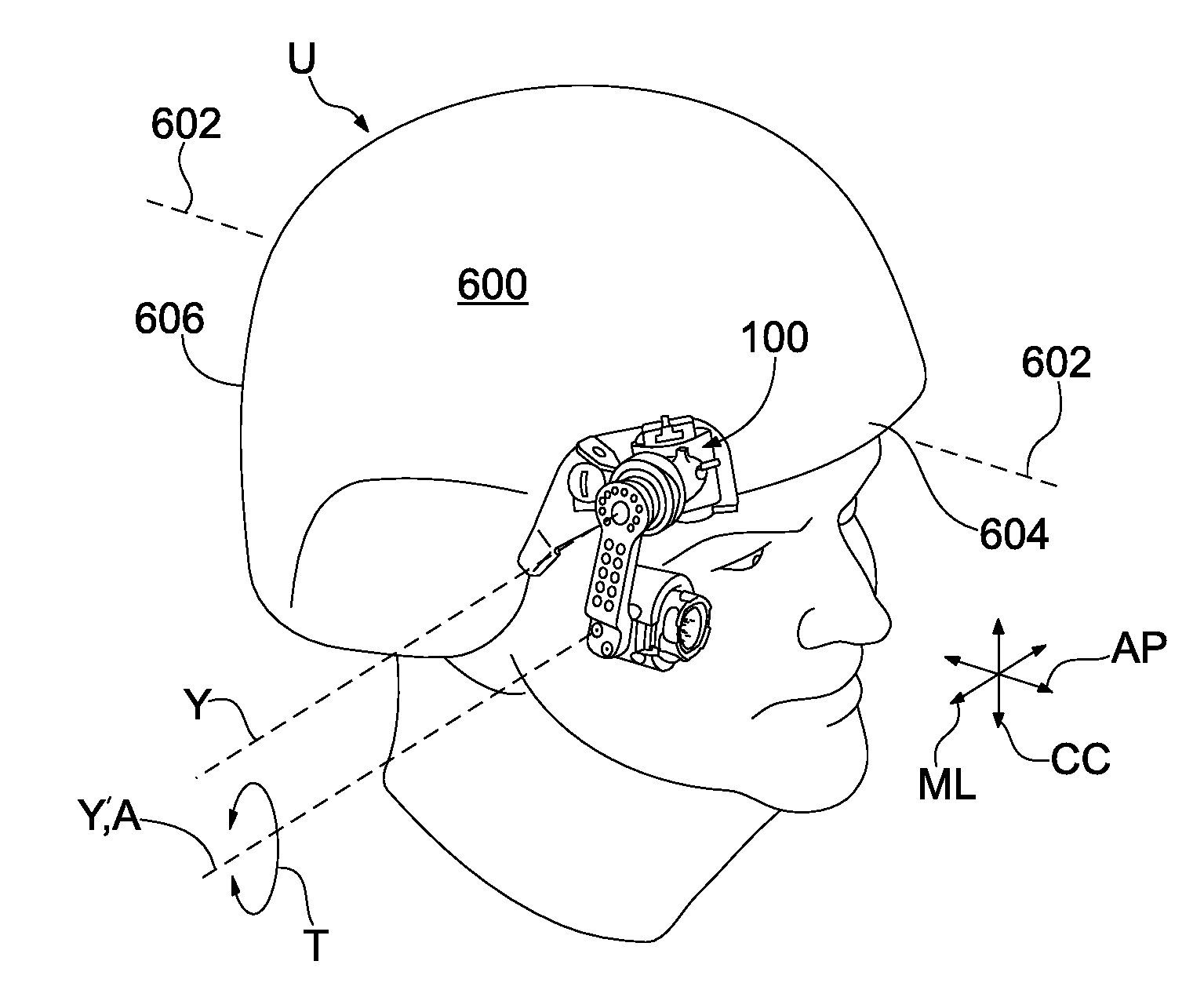 Side positioned vision enhancement device mount