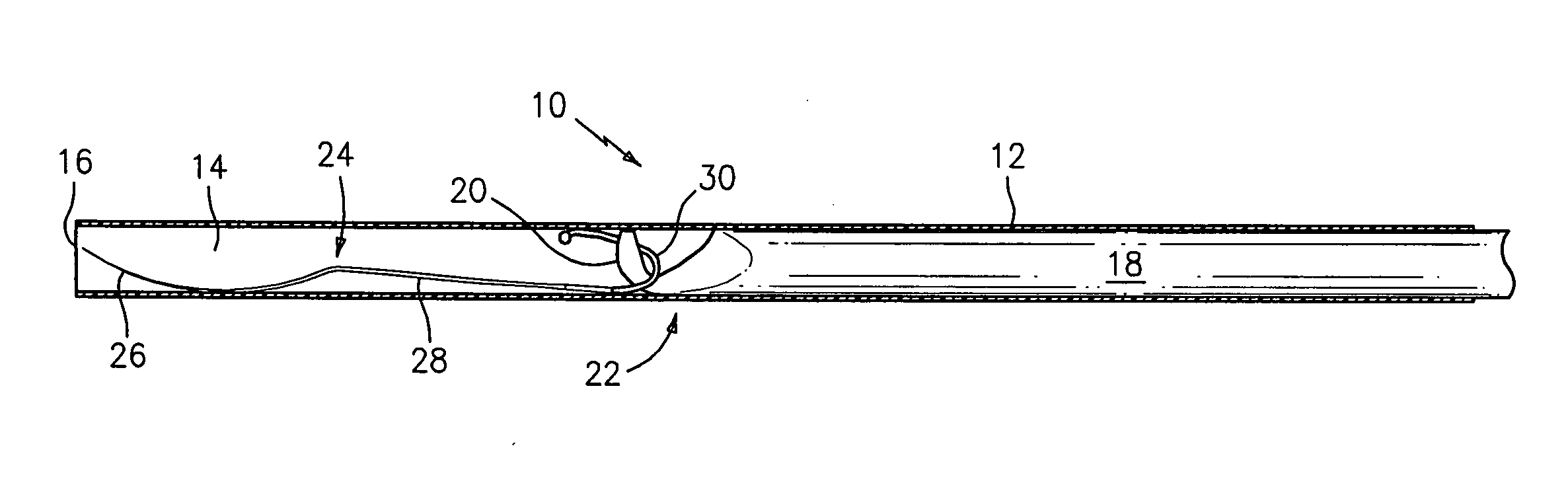 Hooked rod delivery system for use in minimally invasive surgery