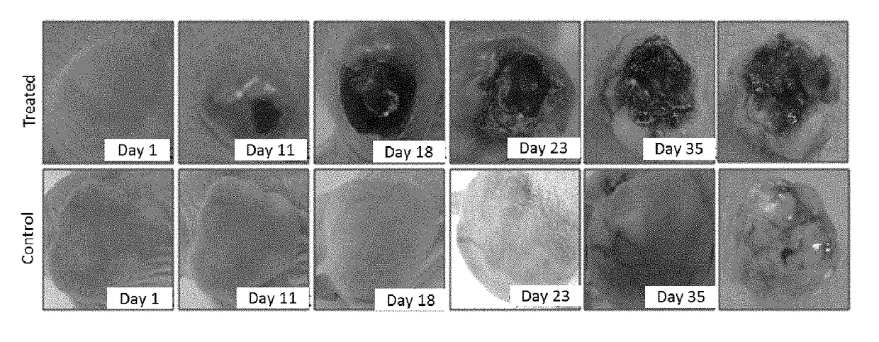 Application of derivative of clostridium ghonii