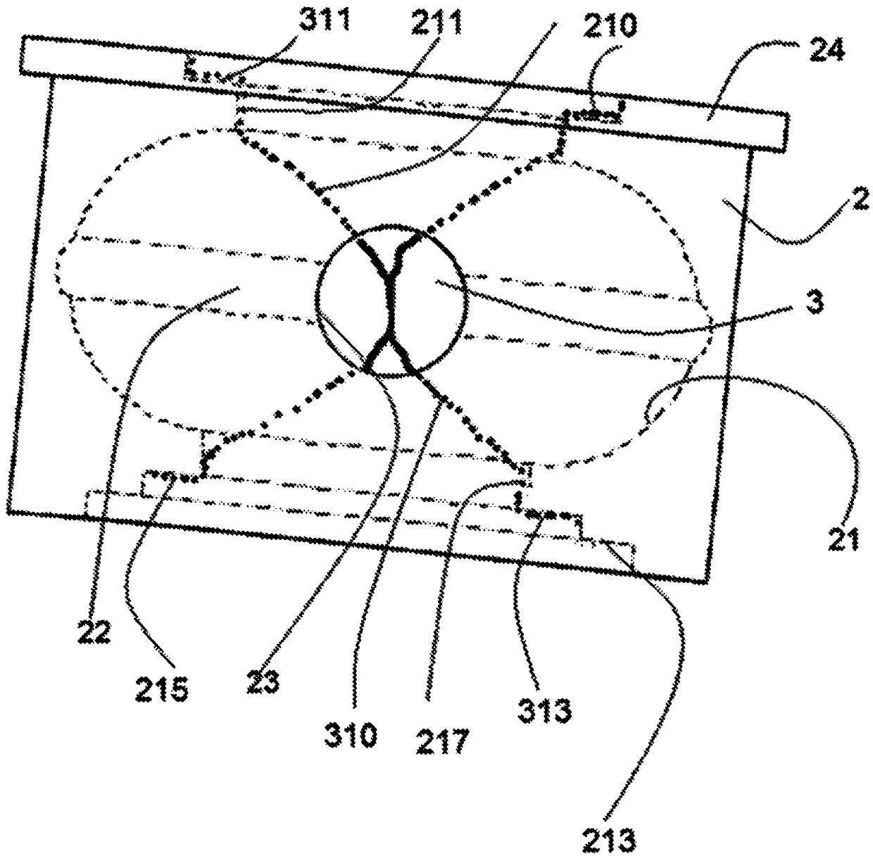 Device allowing an alimentary bolus flow between two stomas