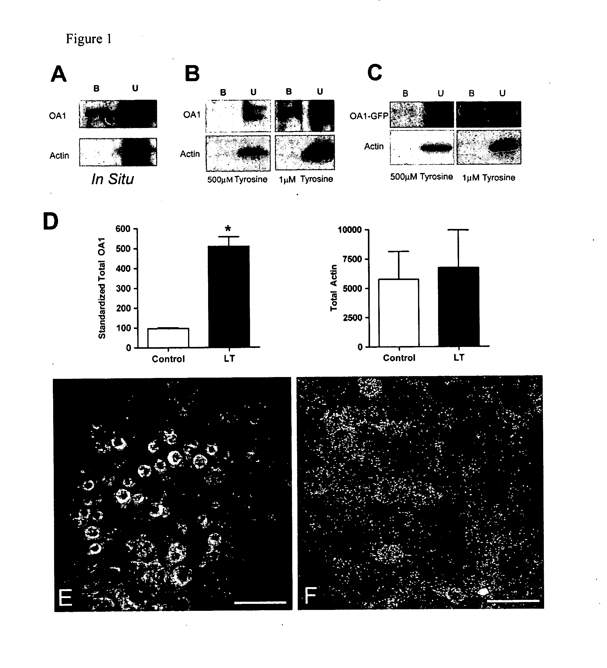 Methods and Compositions for Treating and Identifying Compounds to Treat Age-Related Macular Degeneration