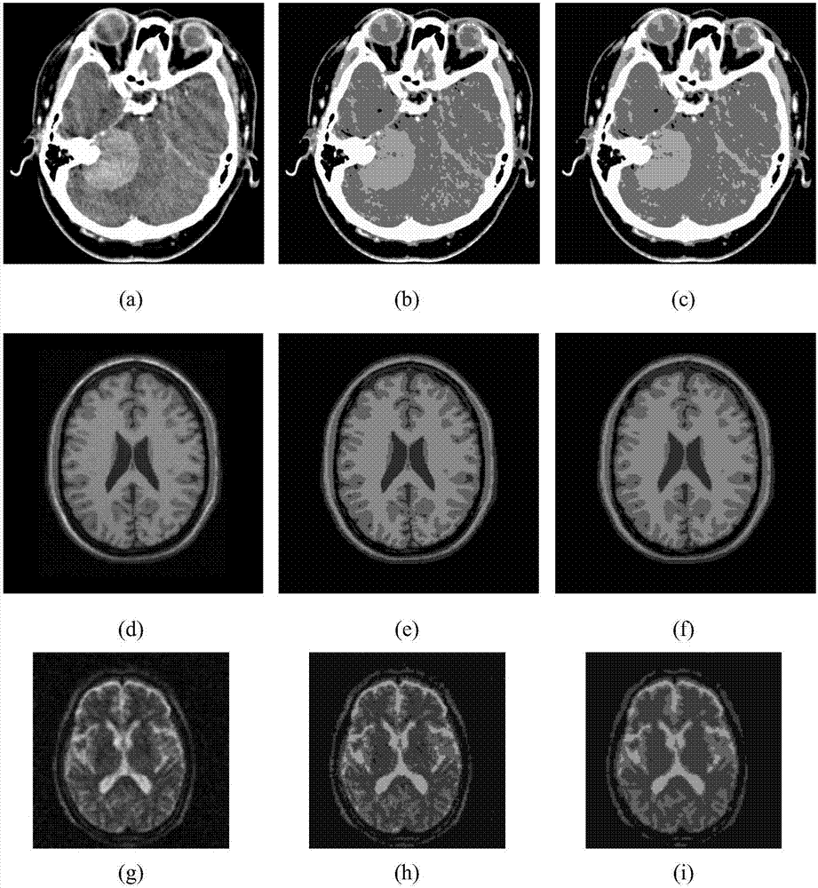 Fuzzy clustering medical image segmentation method based on medical tissue organ own characteristics