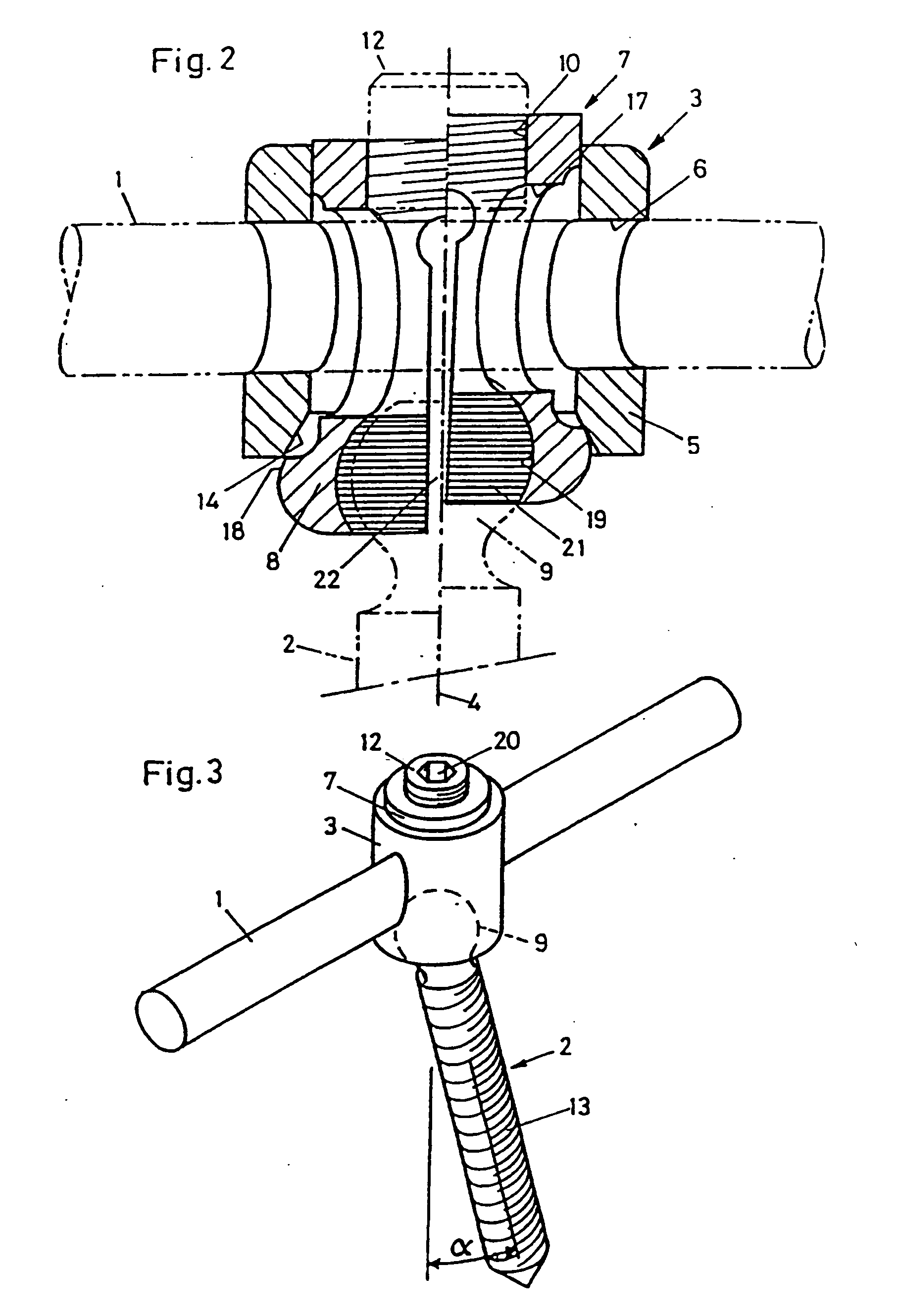 Device for connecting a longitudinal bar to a pedicle screw