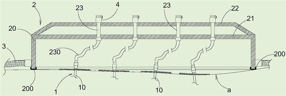 Intraperitoneal hyperthermic perfusion catheter fixing device for ovarian cancer treatment