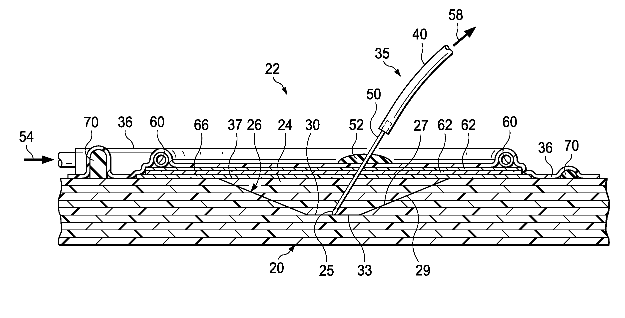 Method and apparatus for reworking structures