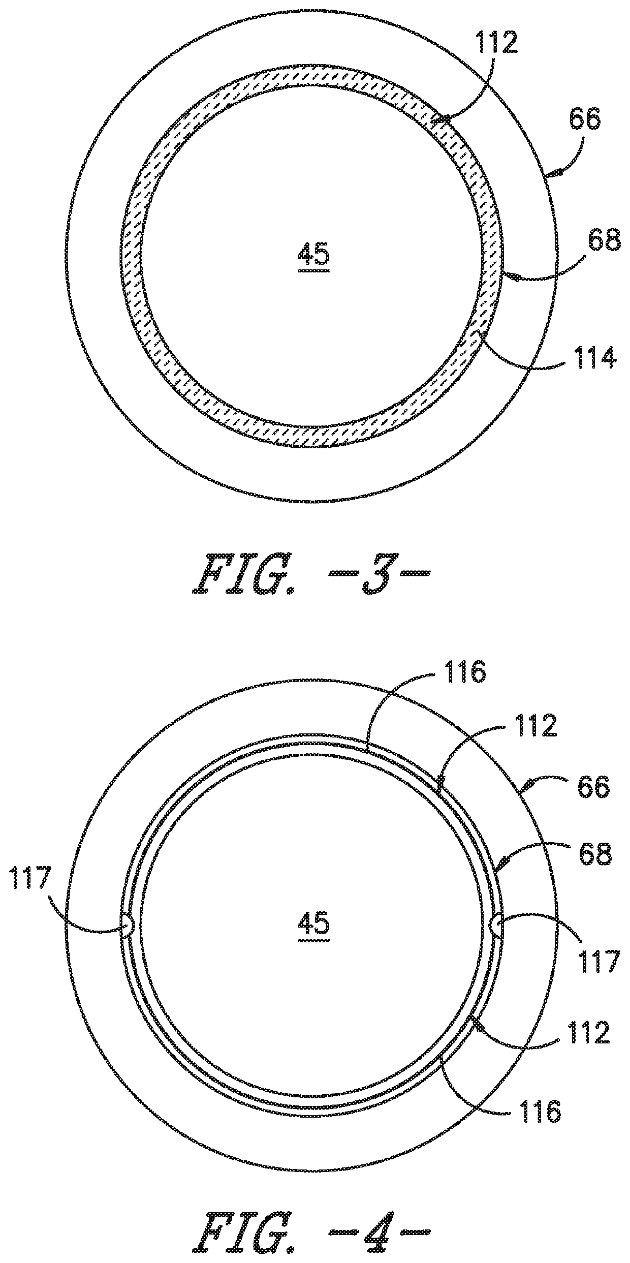 System and method for in situ repair of gas turbine engines